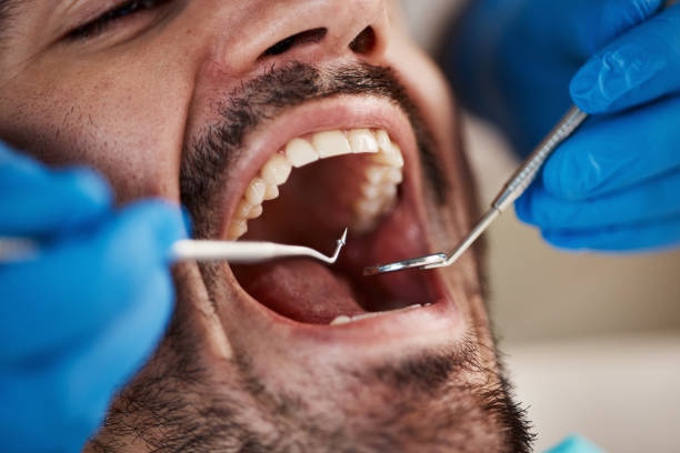Best Broken or Chipped Tooth Repair in Northglenn, CO